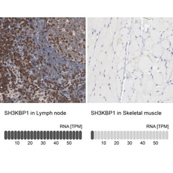 CIN85/SH3KBP1 Antibody, Novus Biologicals:Antibodies:Primary Antibodies